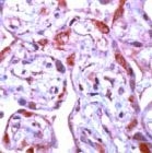 PAB11701 - MMP-1