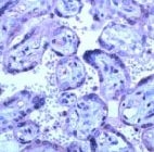 PAB11703 - MMP-14 / MT1-MMP