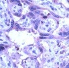 PAB11705 - MMP-19