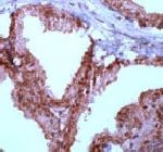 PAB11711 - RELA / NF-kB p65