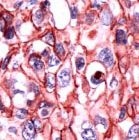 PAB11722 - Catenin delta-1