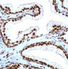 PAB11724 - CDKN1B / KIP1