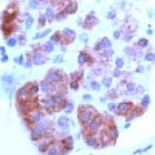 PAB11727 - PTH Receptor 1