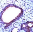 PAB11732 - CD140b / PDGFRB