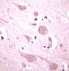 PAB11733 - PLCB1