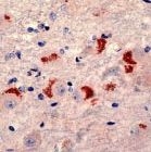 PAB11738 - Presenilin-1