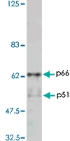 PAB1174 - HIV-1