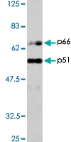 PAB1175 - HIV-1