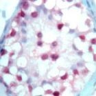 PAB11750 - RAR-beta / RARB