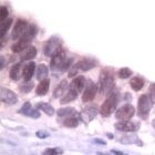 PAB11755 - SKP1 / OCP2