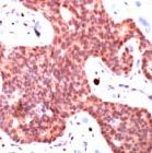 PAB11756 - SMAD3