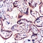 PAB11758 - SOCS6 / CIS4
