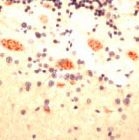 PAB11759 - SCN1A
