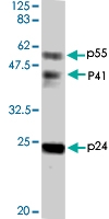 PAB1176 - HIV-1