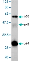PAB1177 - HIV-1