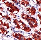 PAB11772 - Somatotropin / Growth Hormone / GH1