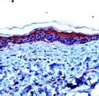 PAB11775 - Involucrin / IVL