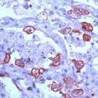 PAB11777 - Cytokeratin 8
