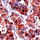 PAB11778 - Luteinizing hormone beta (LSH-beta)