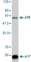 PAB1178 - HIV-1