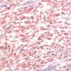 PAB11781 - Melanoma gp100