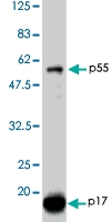 PAB1179 - HIV-1