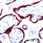 PAB11792 - Placental Lactogen
