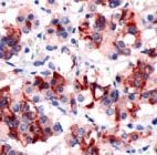 PAB11794 - Prolactin / PRL