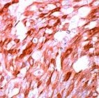 PAB11798 - S100A1