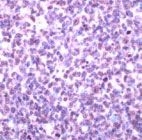 PAB11806 - SP1 / TSFP1