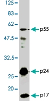 PAB1181 - HIV-1