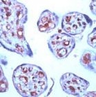 PAB11811 - STAT6