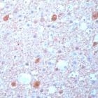 PAB11818 - Beta-Synuclein / SCNB