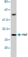 PAB1182 - HIV-1