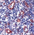 PAB11825 - TIE1
