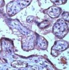 PAB11828 - TIMP3