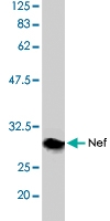 PAB1183 - HIV-1