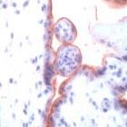 PAB11835 - TGFBR1 / ALK-5
