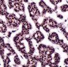 PAB11836 - Thymidylate synthase (TS)