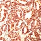 PAB11839 - TUBG1 / Tubulin gamma 1