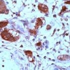 PAB11851 - XRCC2