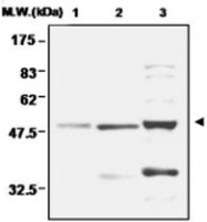 PAB1186 - Ferredoxin reductase