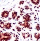 PAB11871 - STK17B / DRAK2