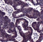 PAB11884 - MLH1