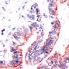 PAB11888 - Occludin