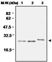 PAB1189 - Peroxiredoxin-4 / PRDX4