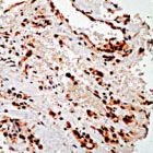 PAB11890 - CD140a / PDGFRA