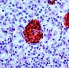 PAB11921 - Neuron specific enolase
