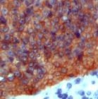 PAB11925 - Cytokeratin 20