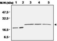 PAB1193 - Superoxide Dismutase 1 / SOD1